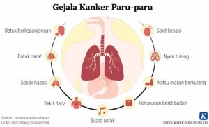 Deteksi Dini Kanker Paru: Pentingnya Skrining untuk Pengobatan yang Tepat