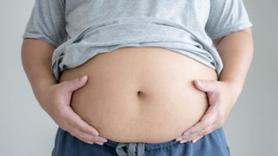 Panduan Lengkap Mengatasi Perut Buncit Secara Alami dan Efektif